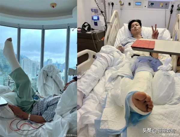 张晋到底有多能打?2023张晋拍戏受伤