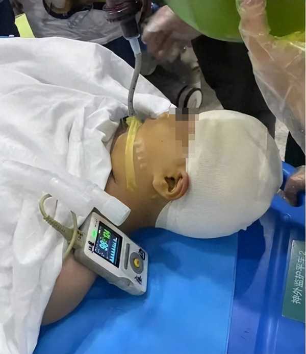 被打破头骨女孩:老师故意打我