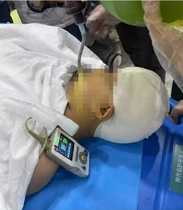 小学生被男教师打碎头骨?警方介入