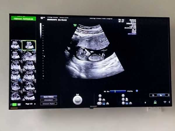 “金龟子”女儿官宣怀孕!预产期在明年3月