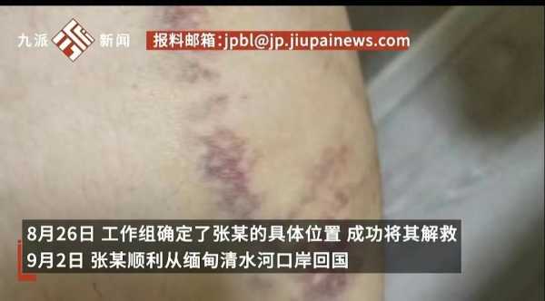 9岁女子被骗缅甸获救时遍体鳞伤"