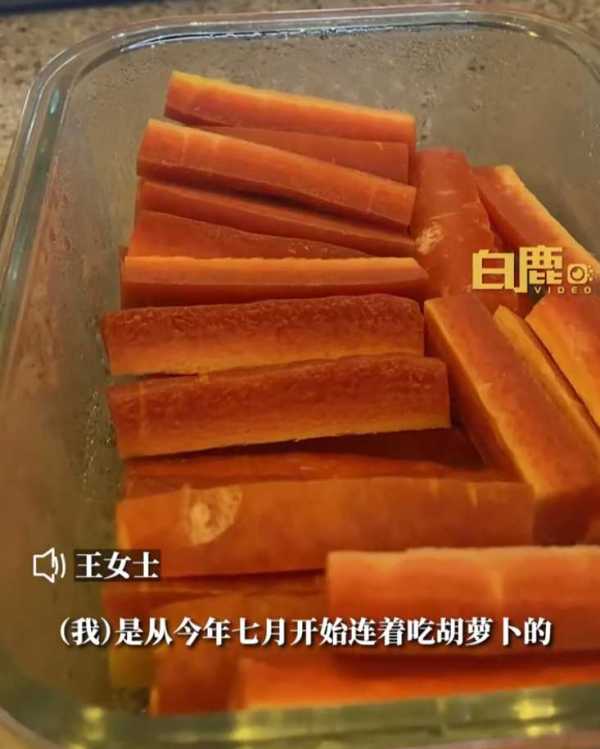 女子为减肥连吃3月胡萝卜变小橘人