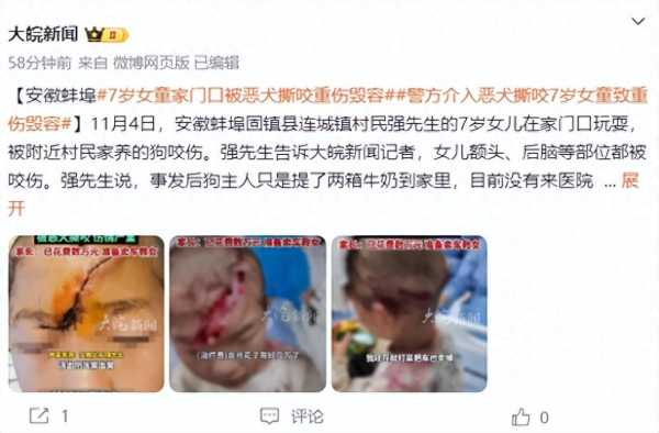 安徽7岁女童被恶犬撕咬致毁容