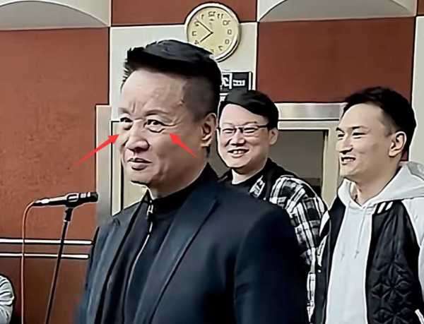 阎维文最新消息:近况曝光,满脸皱纹变化大