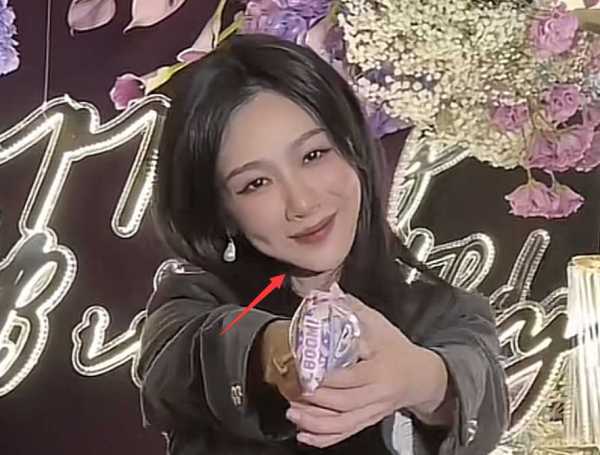 杨紫最近的新消息!被曝整容,脸肿僵硬