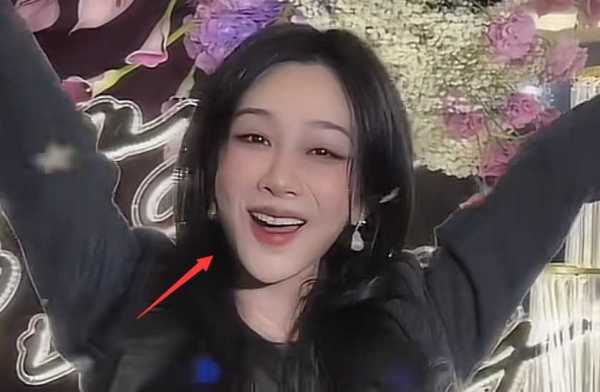杨紫最近的新消息!被曝整容,脸肿僵硬