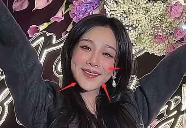 杨紫最近的新消息!被曝整容,脸肿僵硬