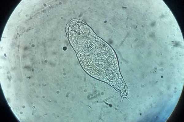 鄱阳湖轮虫每天造1.33亿亿塑料颗粒