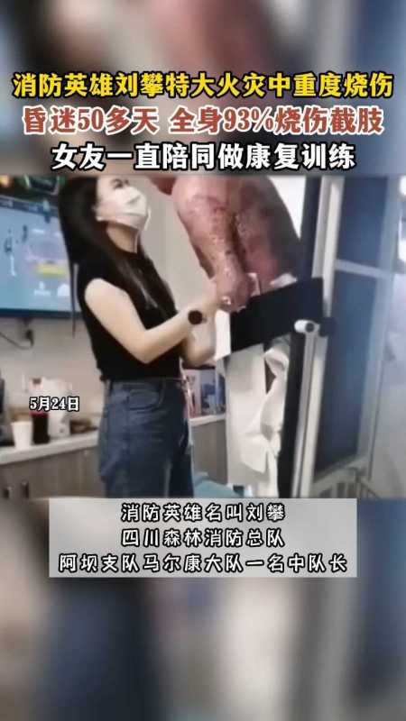 重度烧伤消防员刘攀女友宣布怀孕