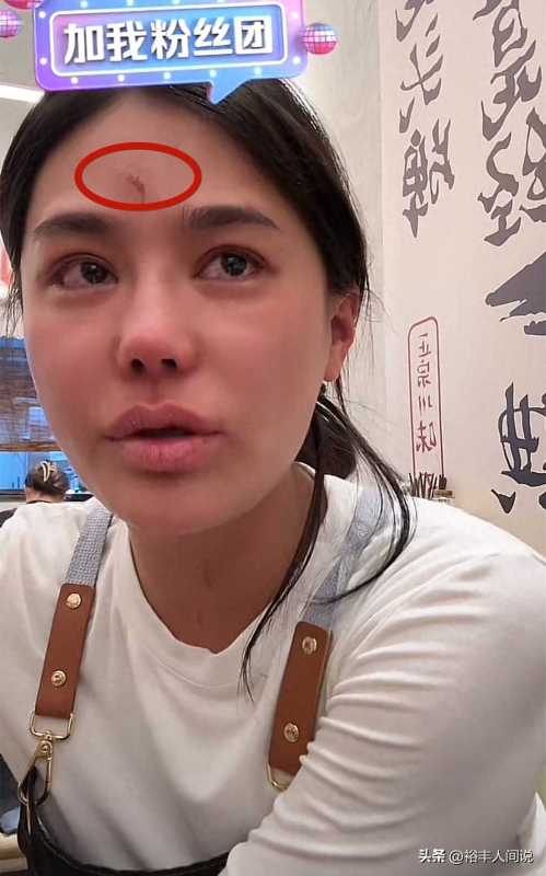 网红樊小慧称被前婆婆上门殴打