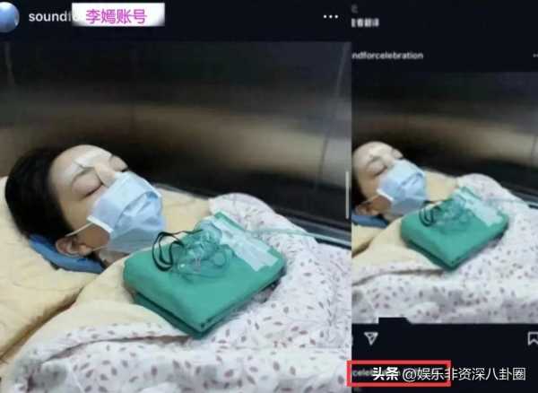 王菲女儿晒唇腭裂手术照!轻舟已过万重山
