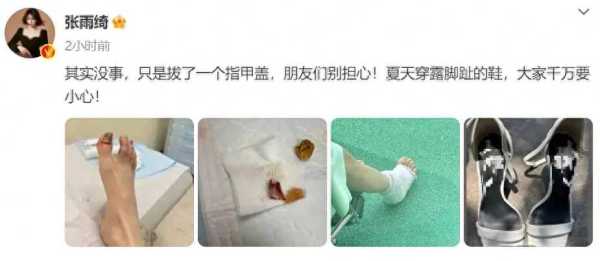 张雨绮拔了一个脚指甲!隔着屏幕都觉得疼