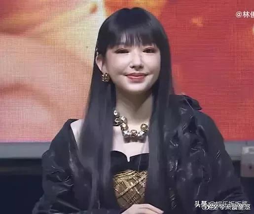 程潇脸肿了!面部馒化严重,网友直呼认不出