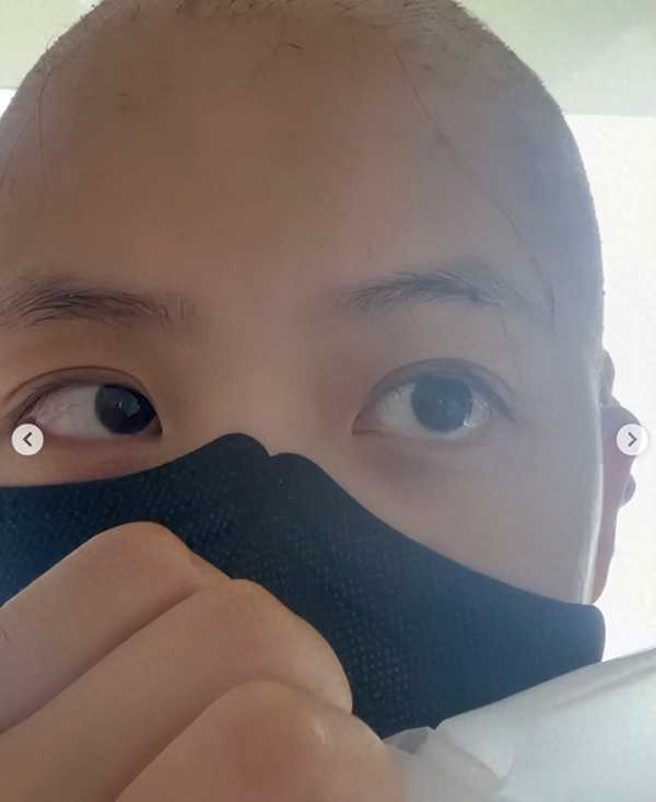韩国女艺人金智源确诊白血病